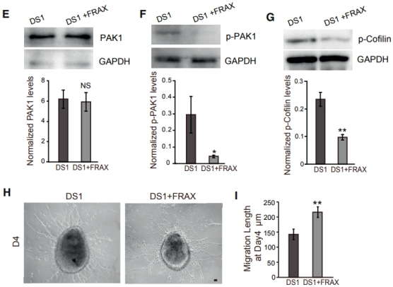 2018年干細(xì)胞治療唐氏綜合癥臨床案例 2018年干細(xì)胞治療唐氏綜合癥臨床案例