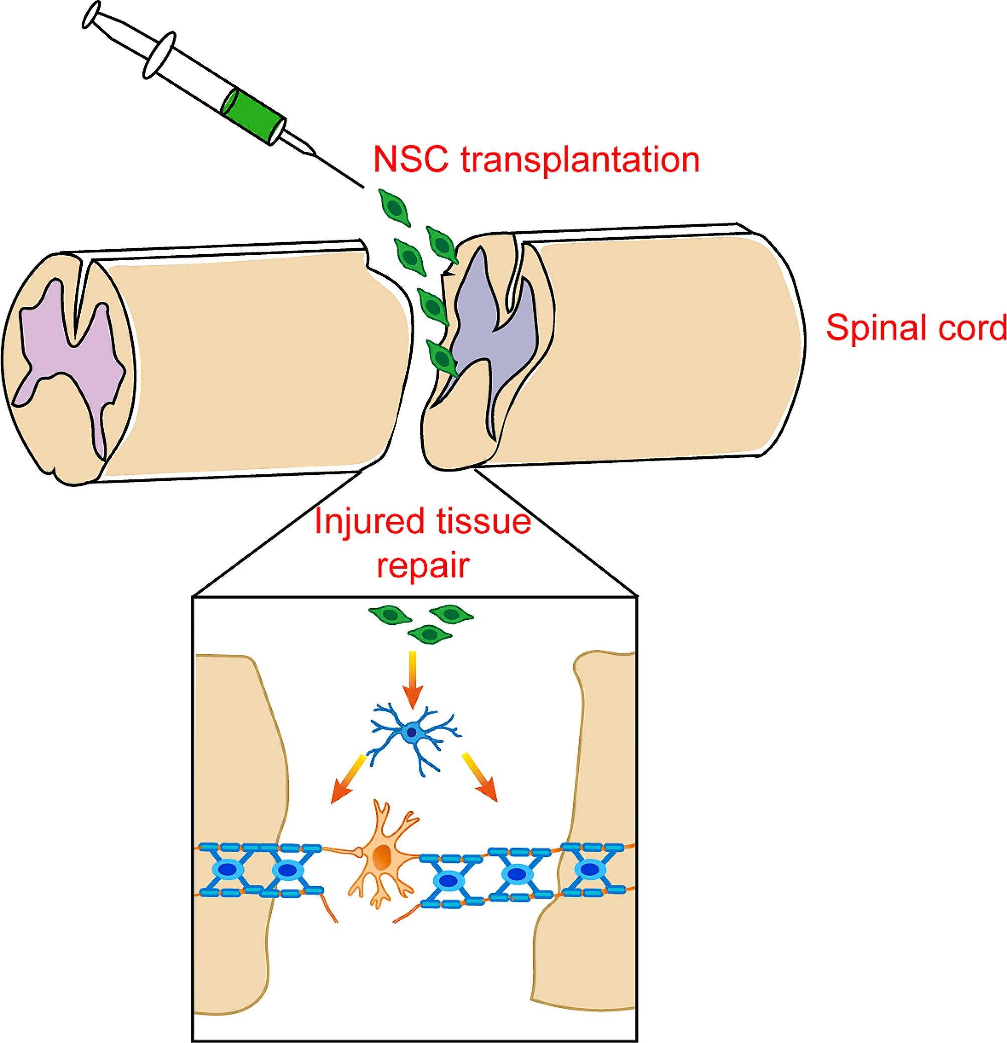 圖3:神經干細胞移植在脊髓損傷修復和恢復中的應用 圖3:神經干細胞移植在脊髓損傷修復和恢復中的應用