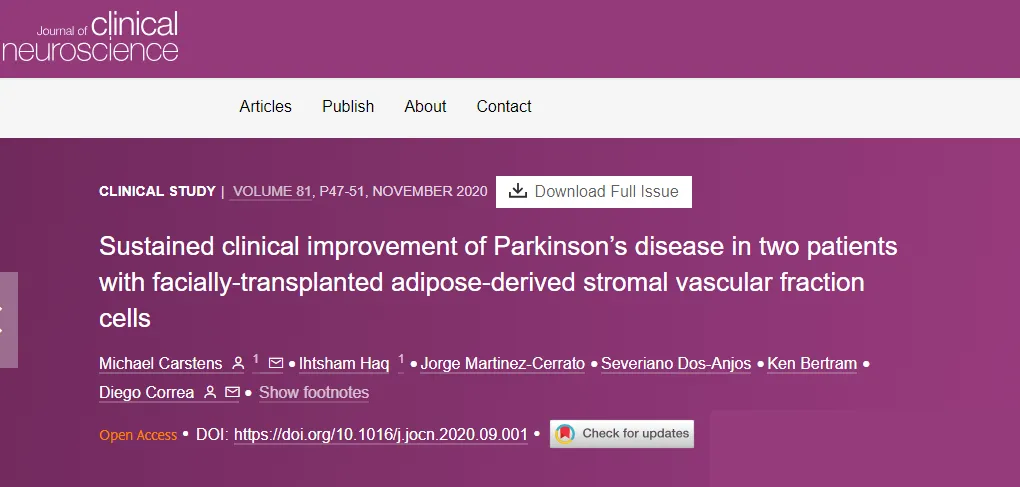 面部移植脂肪來源的基質血管成分細胞后,兩名帕金森病患者病情持續改善 面部移植脂肪來源的基質血管成分細胞后,兩名帕金森病患者病情持續改善