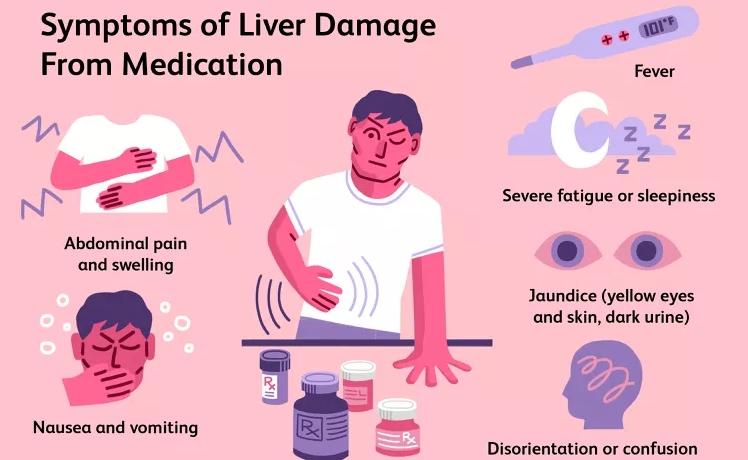 藥物導致肝衰竭的早期跡象 藥物導致肝衰竭的早期跡象