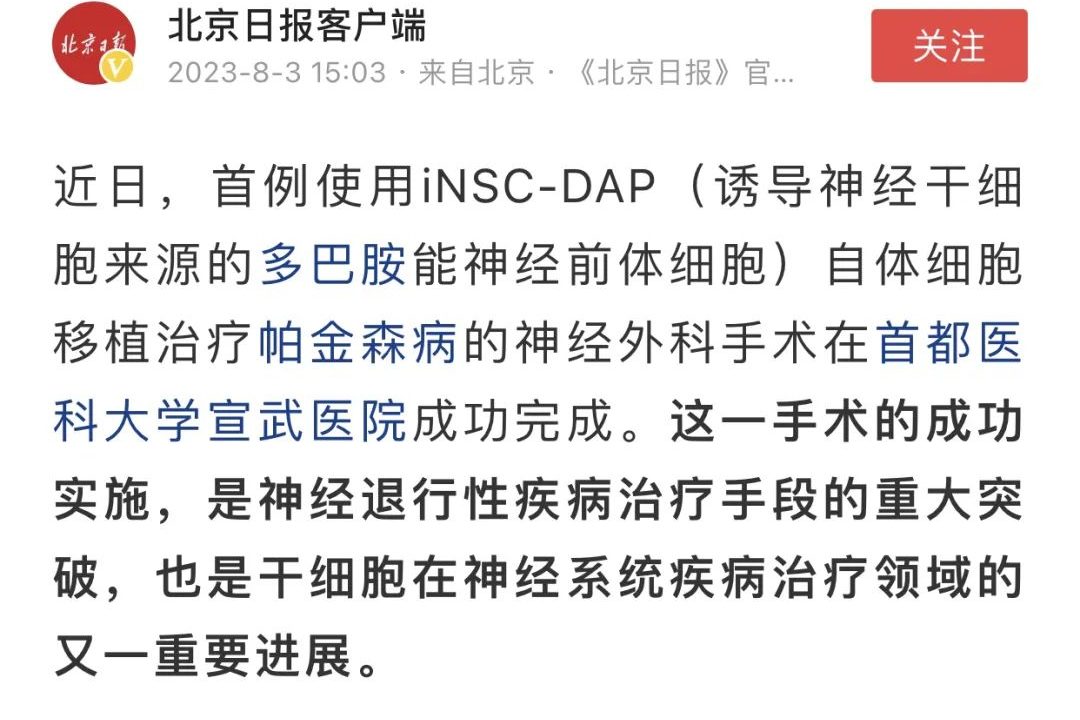 首例使用iNSC-DAP(誘導神經干細胞來源的多巴胺能神經前體細胞)自體細胞移植治療帕金森病的神經外科手術在首都醫科大學宣武醫院成功完成。 首例使用iNSC-DAP(誘導神經干細胞來源的多巴胺能神經前體細胞)自體細胞移植治療帕金森病的神經外科手術在首都醫科大學宣武醫院成功完成。
