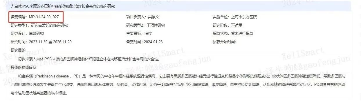 臨床級iPSC衍生多巴胺能神經前體細胞治療帕金森病的臨床研究 臨床級iPSC衍生多巴胺能神經前體細胞治療帕金森病的臨床研究