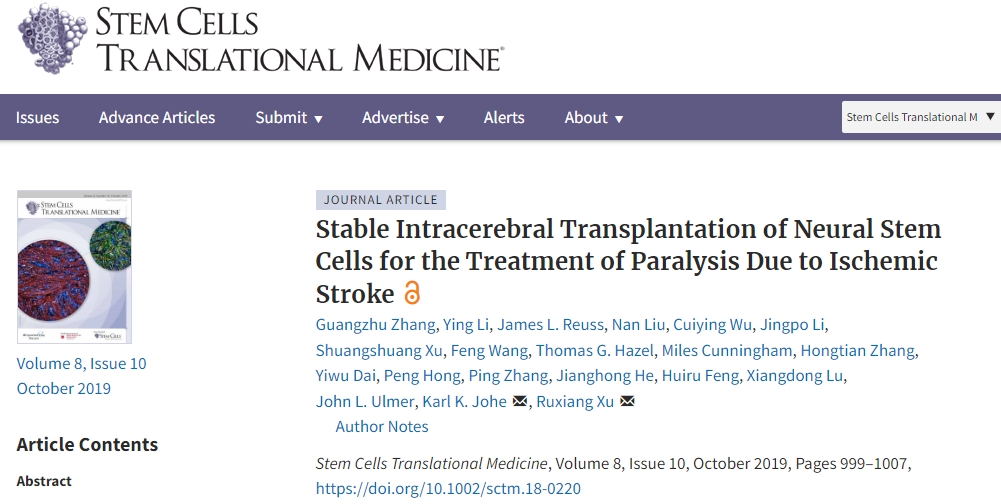 解放軍總醫(yī)院：神經(jīng)干細(xì)胞移植治療缺血性中風(fēng)，臨床表明效果良好！
