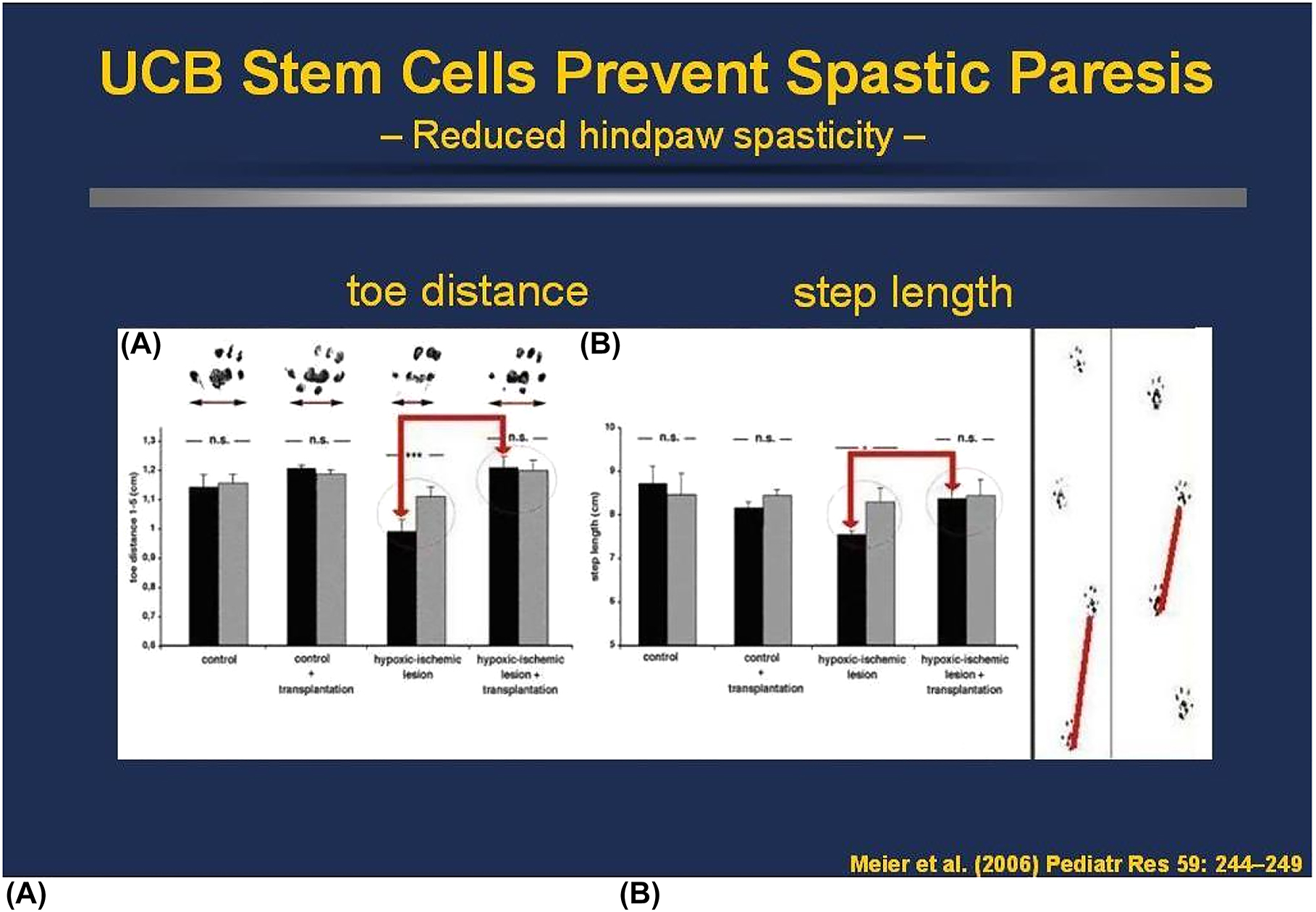 人類臍帶血MNC可預防PN7新生大鼠模型的痙攣性輕癱 人類臍帶血MNC可預防PN7新生大鼠模型的痙攣性輕癱