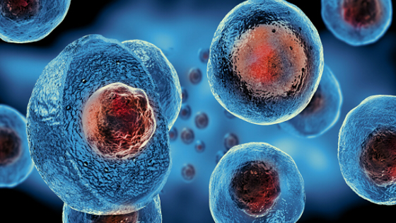 干細胞治療類風濕關節炎的作用機制