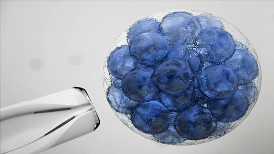 干細(xì)胞治療精神分裂癥的作用機制