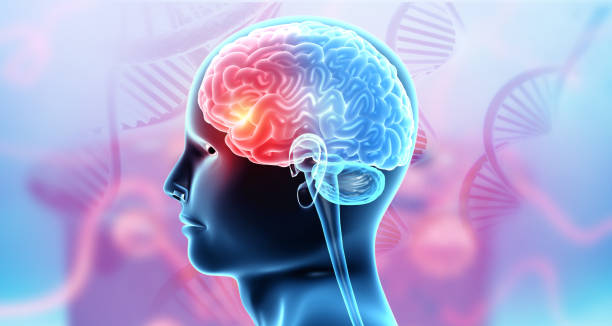 什么是腦卒中 什么是腦卒中