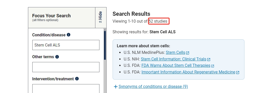 干細胞治療漸凍癥的臨床研究進展 干細胞治療漸凍癥的臨床研究進展