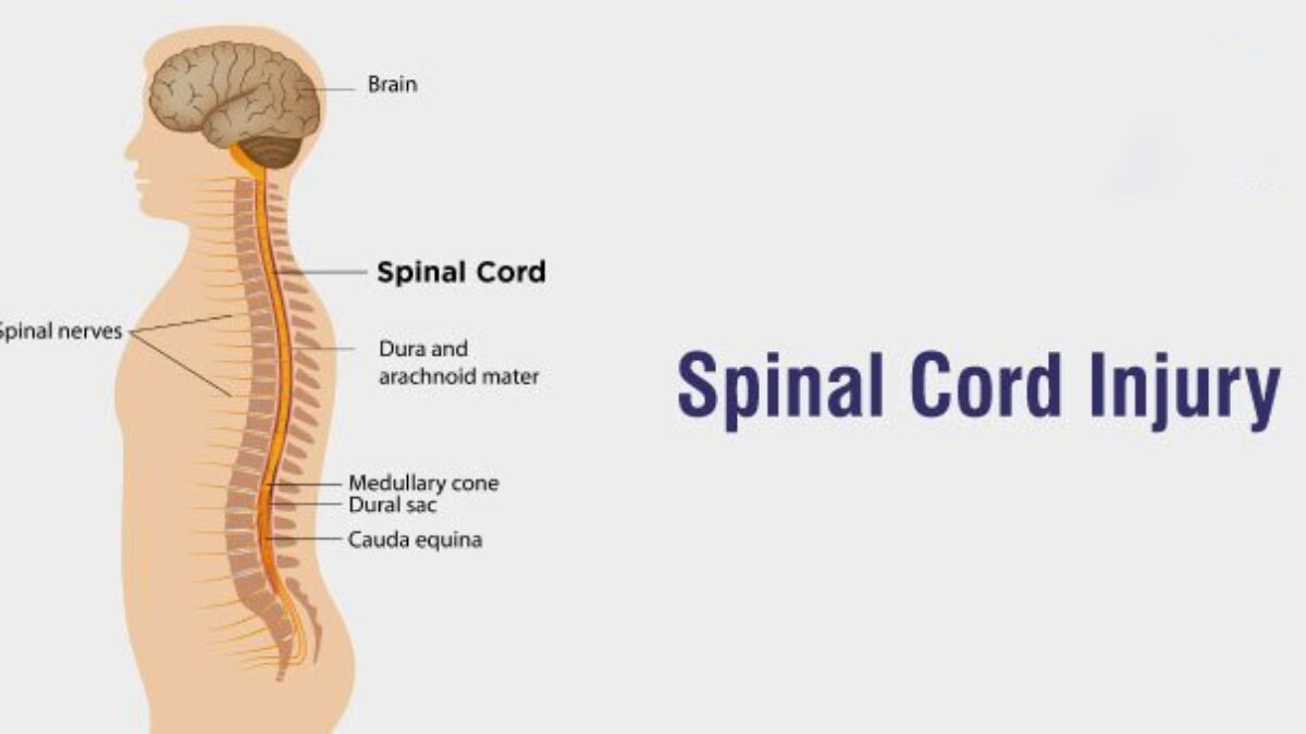 3項(xiàng)研究75例患者,評(píng)估干細(xì)胞治療脊髓損傷的安全性和有效性 3項(xiàng)研究75例患者,評(píng)估干細(xì)胞治療脊髓損傷的安全性和有效性