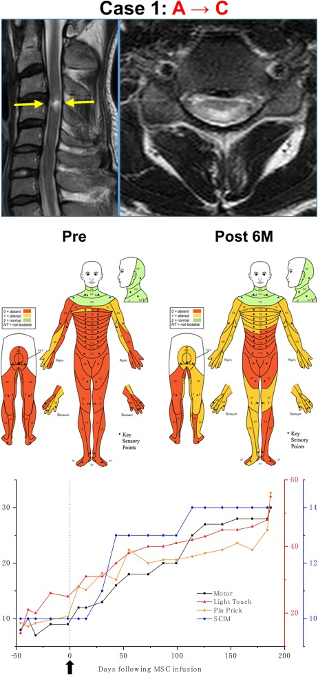 案例1。 案例1。