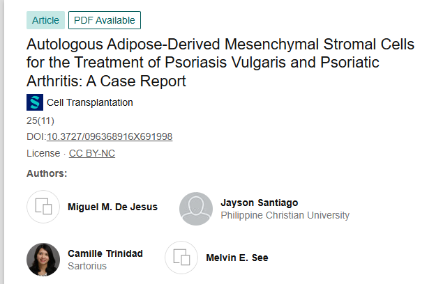 《自體脂肪來源的間充質基質細胞治療尋常型銀屑病和銀屑病關節炎:病例報告》 《自體脂肪來源的間充質基質細胞治療尋常型銀屑病和銀屑病關節炎:病例報告》