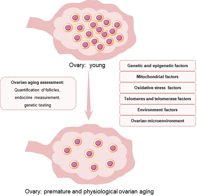 圖1:卵巢中卵泡數(shù)量和卵母細(xì)胞質(zhì)量與POI的關(guān)系示意圖