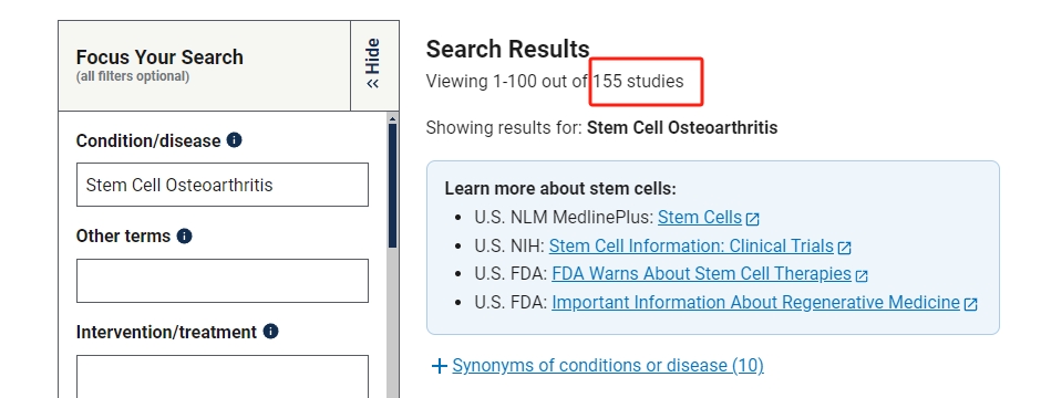 干細胞治療骨關(guān)節(jié)炎的臨床研究進展