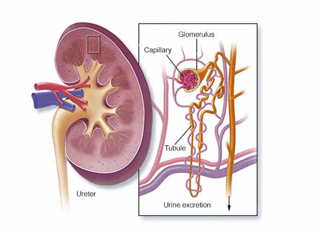 狼瘡性腎炎的腎解刨圖 狼瘡性腎炎的腎解刨圖