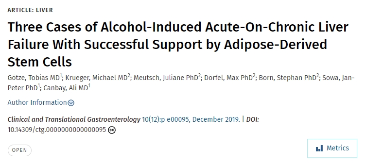 脂肪干細胞成功治療三例酒精性急性肝衰竭 脂肪干細胞成功治療三例酒精性急性肝衰竭