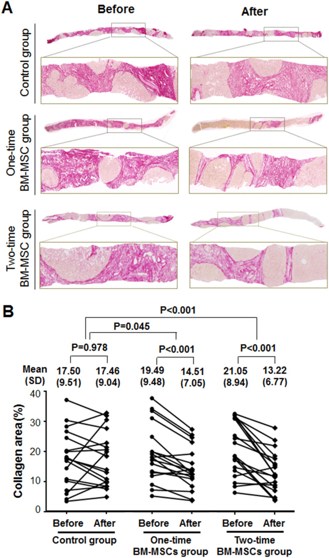 膠原蛋白面積的定量組織學分析。 膠原蛋白面積的定量組織學分析。