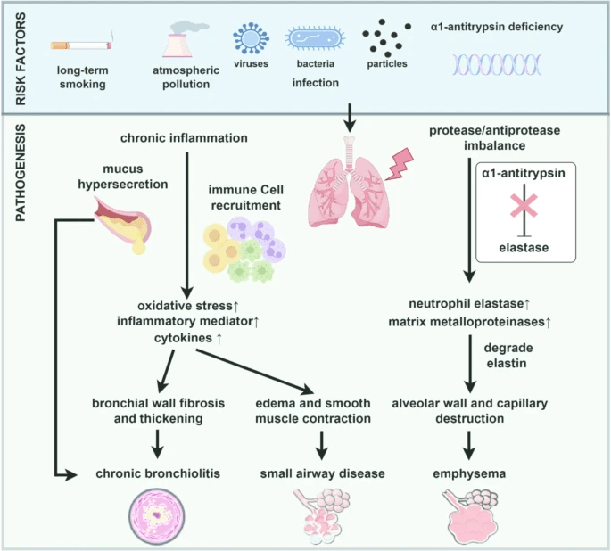 圖1:慢性阻塞性肺疾病的風險因素和發病機制。 圖1:慢性阻塞性肺疾病的風險因素和發病機制。
