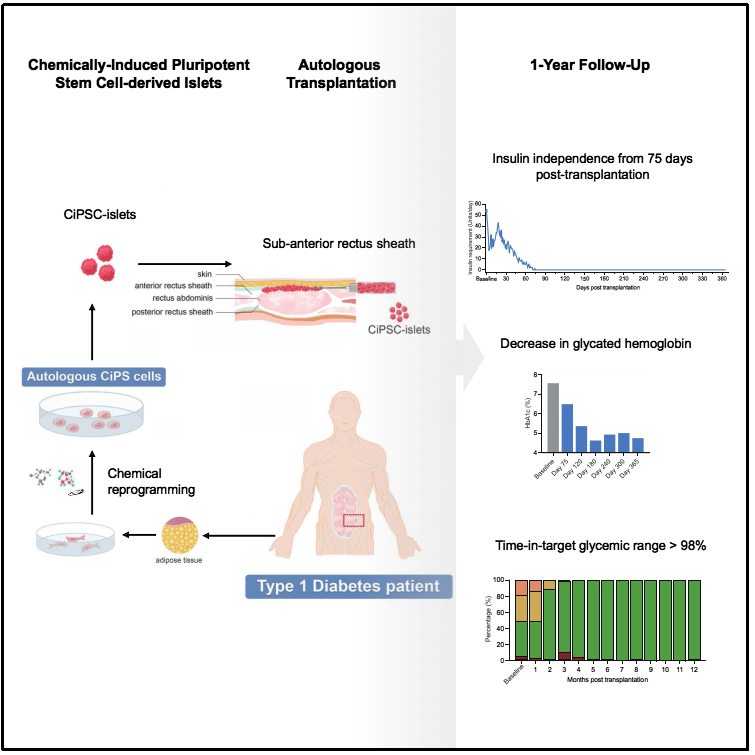 圖1：基于CiPS細(xì)胞治療1型糖尿病的臨床研究的示意圖和治療效果