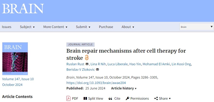 確認(rèn)干細(xì)胞治療中風(fēng)后的大腦修復(fù)機(jī)制,以推動(dòng)干細(xì)胞治療中風(fēng)進(jìn)入臨床至關(guān)重要! 確認(rèn)干細(xì)胞治療中風(fēng)后的大腦修復(fù)機(jī)制,以推動(dòng)干細(xì)胞治療中風(fēng)進(jìn)入臨床至關(guān)重要!