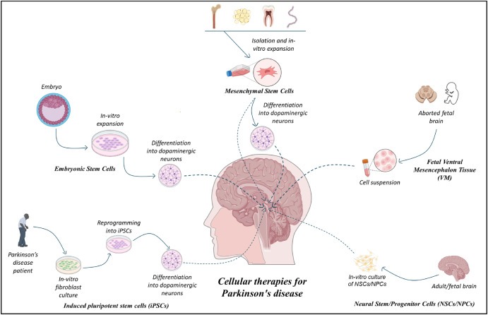 圖1:帕金森病的細(xì)胞療法:胚胎干細(xì)胞 (ESC)、誘導(dǎo)性多能干細(xì)胞 (iPSC)、間充質(zhì)干細(xì)胞 (MSC)、神經(jīng)干細(xì)胞/祖細(xì)胞 (NSC/NPS) 是帕金森病的新興候選藥物。 圖1:帕金森病的細(xì)胞療法:胚胎干細(xì)胞 (ESC)、誘導(dǎo)性多能干細(xì)胞 (iPSC)、間充質(zhì)干細(xì)胞 (MSC)、神經(jīng)干細(xì)胞/祖細(xì)胞 (NSC/NPS) 是帕金森病的新興候選藥物。