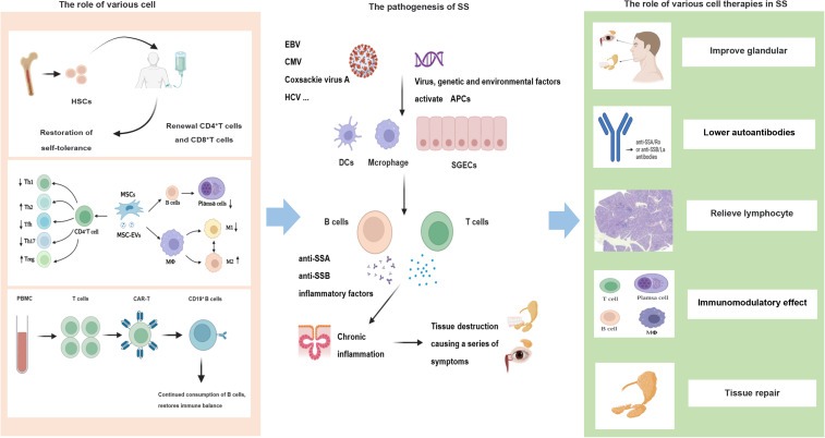 圖1：干燥綜合征的發病機制和細胞治療