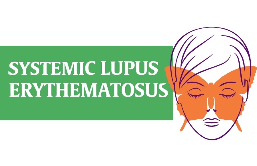 干細胞治療系統性紅斑狼瘡:2020-2024年臨床研究進展 干細胞治療系統性紅斑狼瘡:2020-2024年臨床研究進展