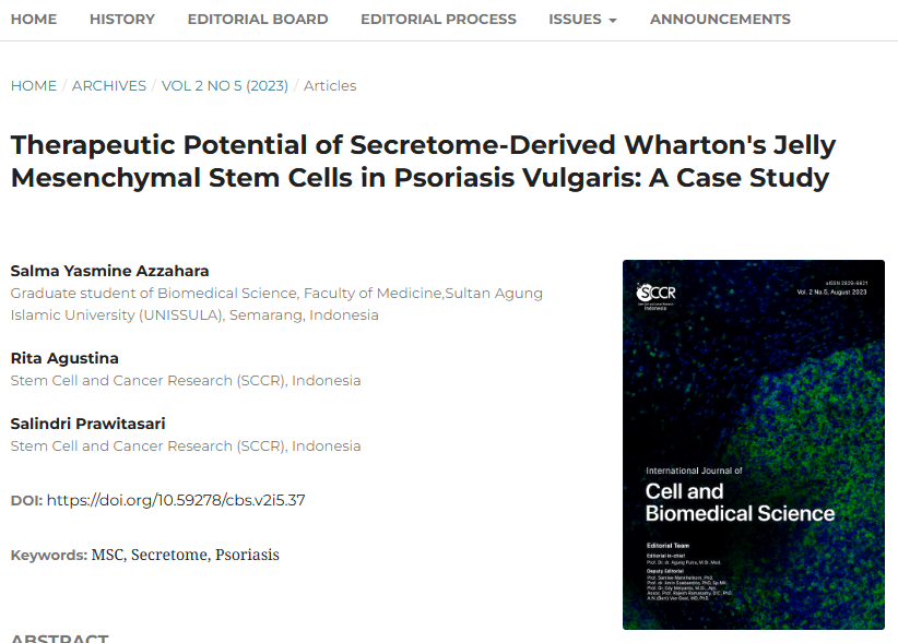 《分泌組衍生的華通氏膠間充質干細胞在尋常型銀屑病中的治療潛力:案例研究》 《分泌組衍生的華通氏膠間充質干細胞在尋常型銀屑病中的治療潛力:案例研究》