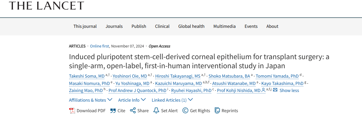 《誘導性多能干細胞來源的角膜上皮用于移植手術：日本的一項單臂、開放標簽、首次人體介入研究》