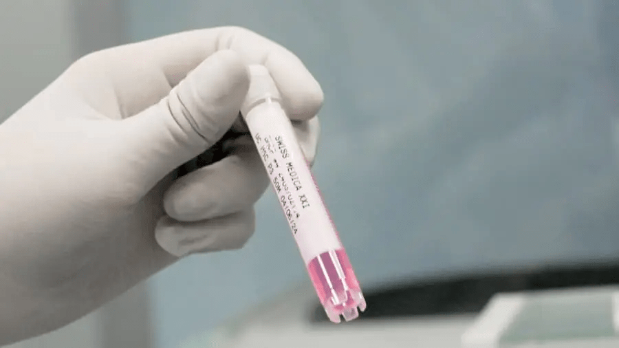 干細胞治療程序：??完整流程和所有步驟！