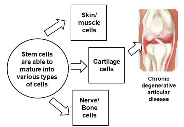 圖3:干細胞治療膝骨關(guān)節(jié)炎 圖3:干細胞治療膝骨關(guān)節(jié)炎
