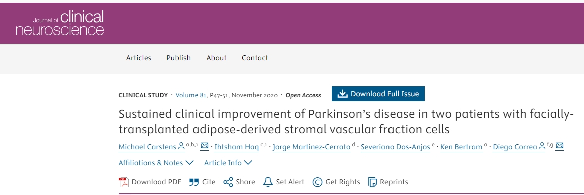 面部移植間充質(zhì)干細(xì)胞治療2例帕金森病患者,患者臨床癥狀持續(xù)改善 面部移植間充質(zhì)干細(xì)胞治療2例帕金森病患者,患者臨床癥狀持續(xù)改善