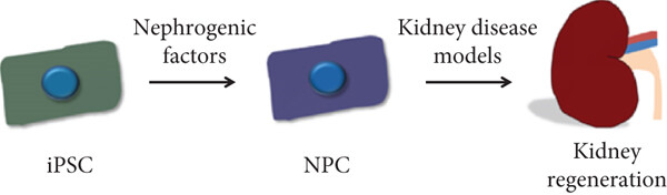 腎臟疾病中的 iPSC 衍生腎細(xì)胞