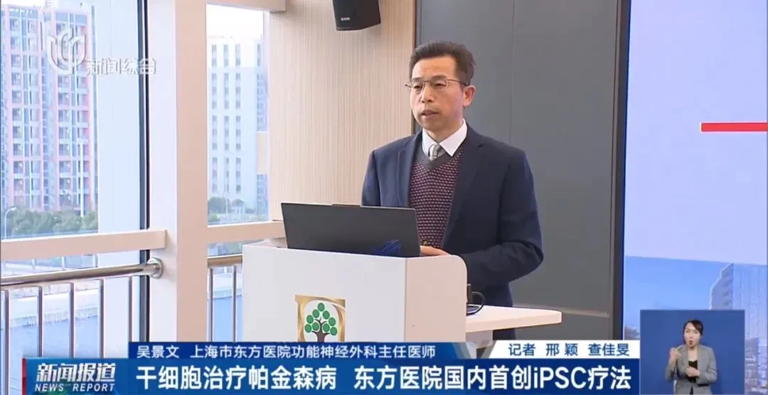 誘導多能干細胞衍生的多巴胺能神經前體細胞移植治療的帕金森病，12個月隨訪