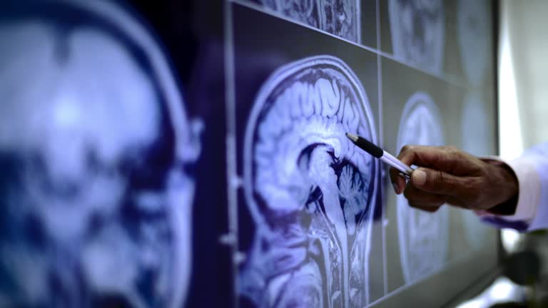 綜述：談談間充質干細胞治療中風的機制、案例及未來發展方向