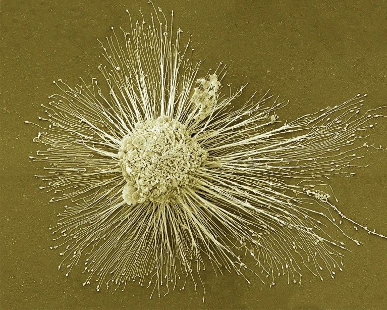 誘導性多能干細胞能夠分化成人體所有類型的細胞,可用于再生受損組織。