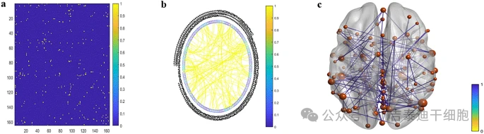 圖5:(a) 加權鄰接矩陣和 (b) 循環網絡顯示多發性硬化癥組在治療6個月后的連接增加。 圖5:(a) 加權鄰接矩陣和 (b) 循環網絡顯示多發性硬化癥組在治療6個月后的連接增加。