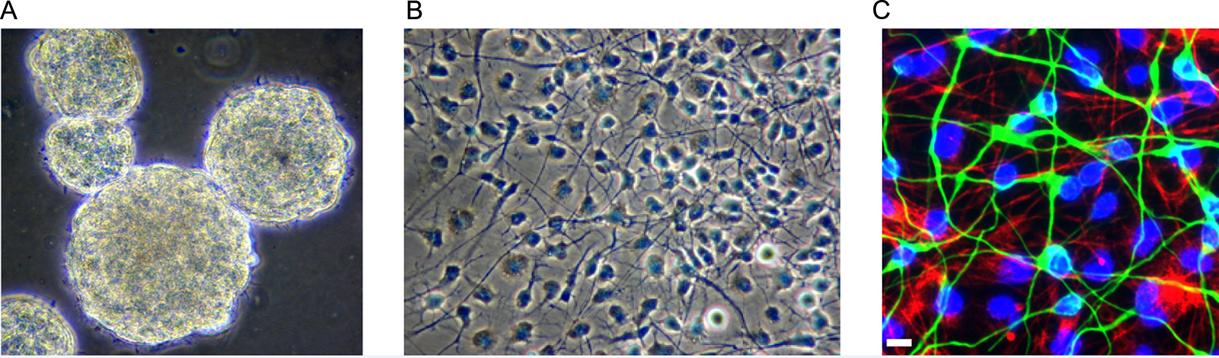 圖1:人類胎兒腦源性神經干細胞。 圖1:人類胎兒腦源性神經干細胞。