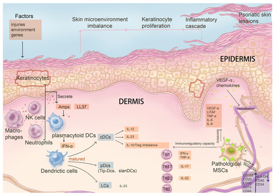 圖3:病理性間充質干細胞與關鍵免疫系統細胞及銀屑病發病因素的影響及相互作用。 圖3:病理性間充質干細胞與關鍵免疫系統細胞及銀屑病發病因素的影響及相互作用。