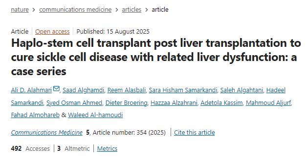 肝移植后單倍體干細(xì)胞移植治療鐮狀細(xì)胞病及相關(guān)肝功能障礙：病例系列