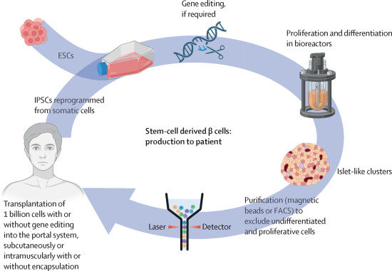 胚胎干細(xì)胞或誘導(dǎo)多能干細(xì)胞來(lái)源的β細(xì)胞的制備和移植 胚胎干細(xì)胞或誘導(dǎo)多能干細(xì)胞來(lái)源的β細(xì)胞的制備和移植
