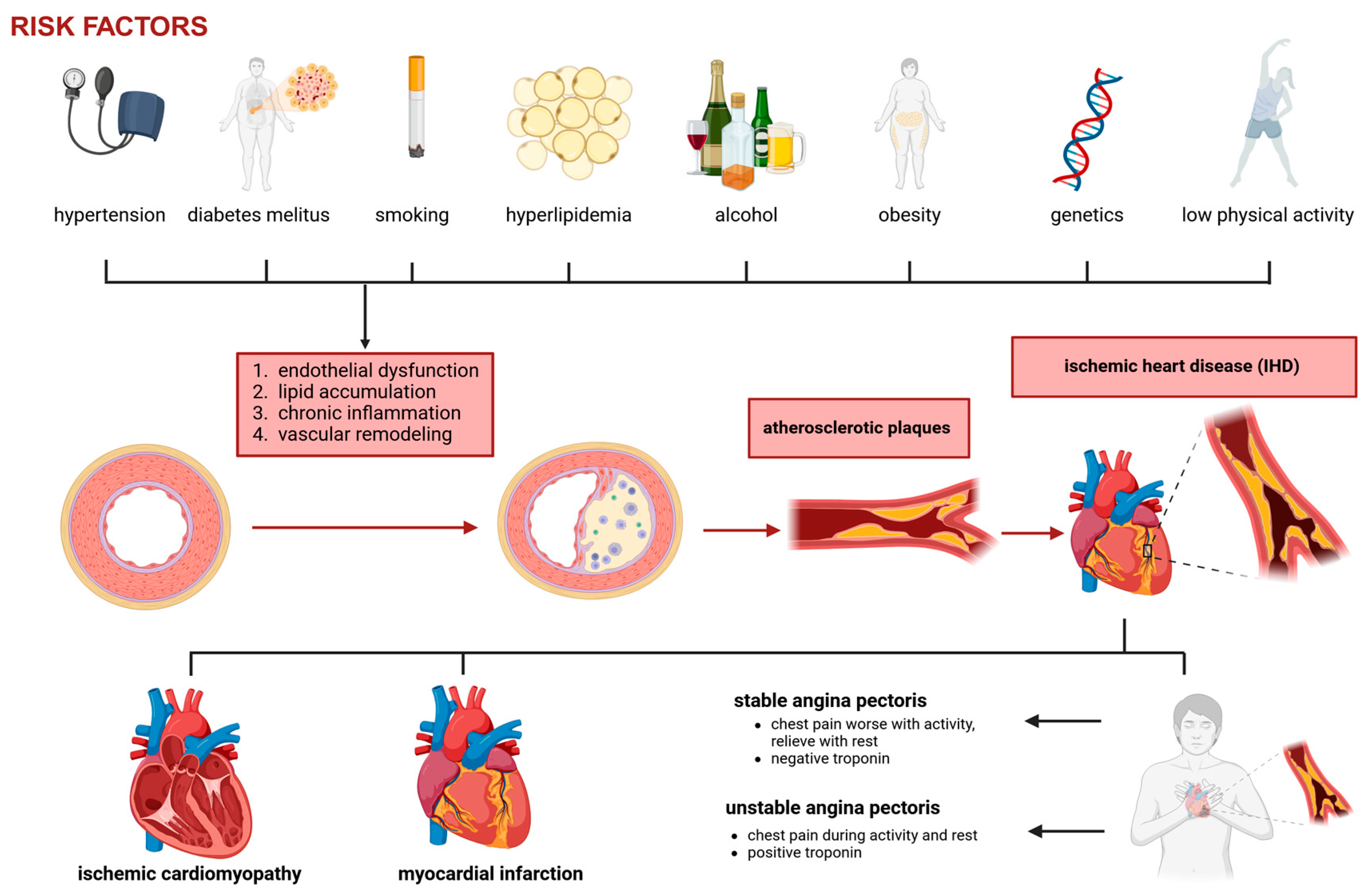圖1:冠狀動脈疾病和缺血性心臟病的病理生理學。 圖1:冠狀動脈疾病和缺血性心臟病的病理生理學。