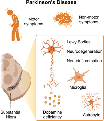 圖1:帕金森病的臨床和神經病理學特征 圖1:帕金森病的臨床和神經病理學特征