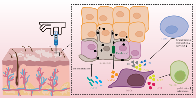 圖1:白癜風患者皮膚注射MSCs后對局部皮膚的潛在免疫調節和抗炎作用 圖1:白癜風患者皮膚注射MSCs后對局部皮膚的潛在免疫調節和抗炎作用