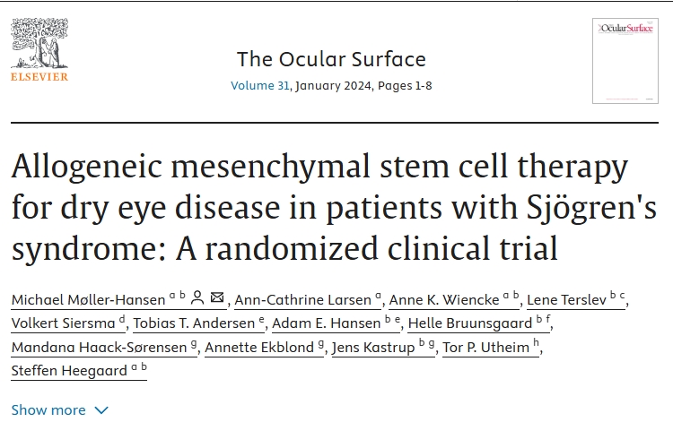 異基因間充質干細胞治療干燥綜合征患者干眼癥:一項隨機臨床試驗 異基因間充質干細胞治療干燥綜合征患者干眼癥:一項隨機臨床試驗