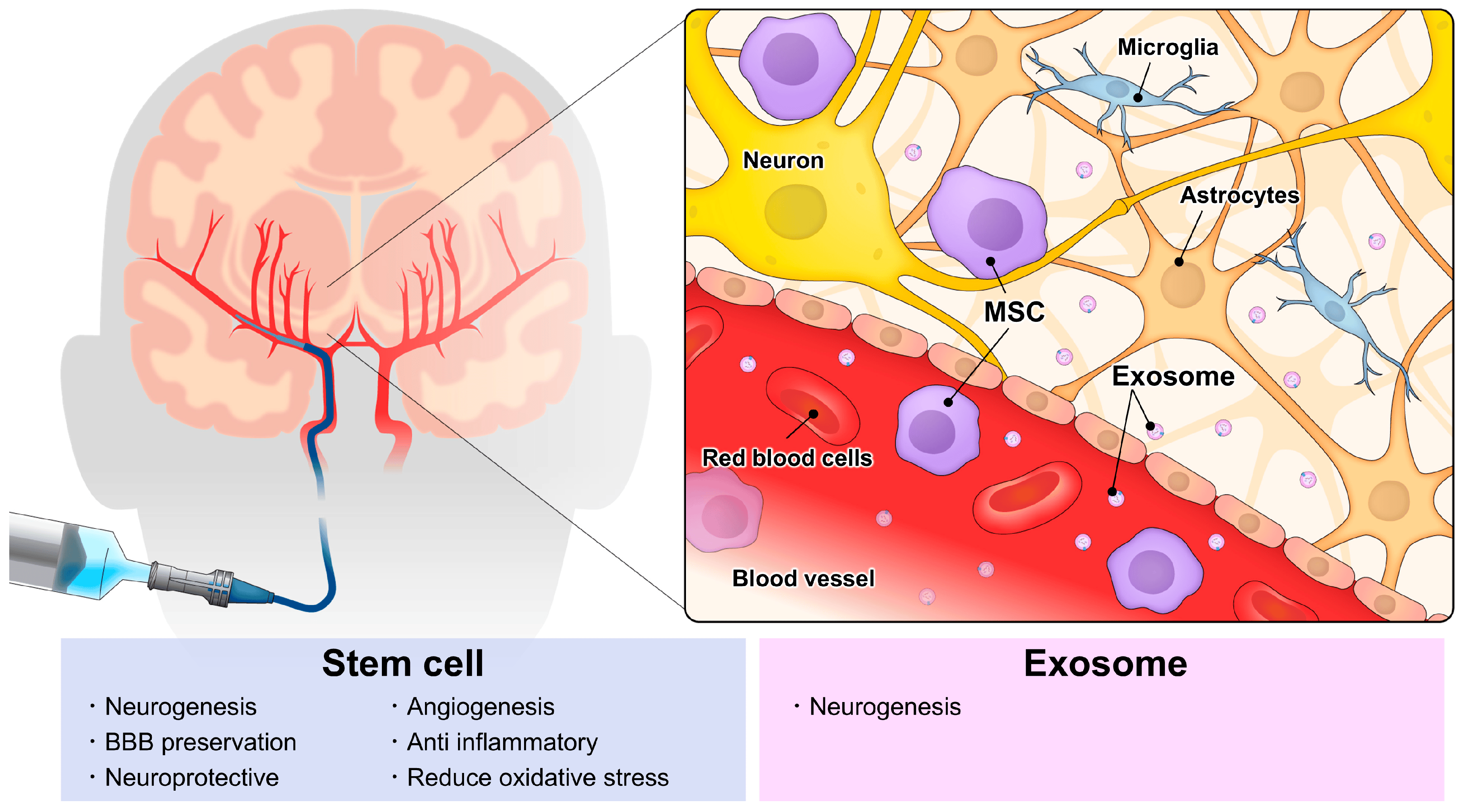 動脈注射干細(xì)胞&外泌體治療神經(jīng)系統(tǒng)疾病,打多少細(xì)胞合適?什么時候移植好? 動脈注射干細(xì)胞&外泌體治療神經(jīng)系統(tǒng)疾病,打多少細(xì)胞好?