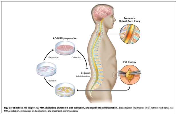 干細胞治療 干細胞治療