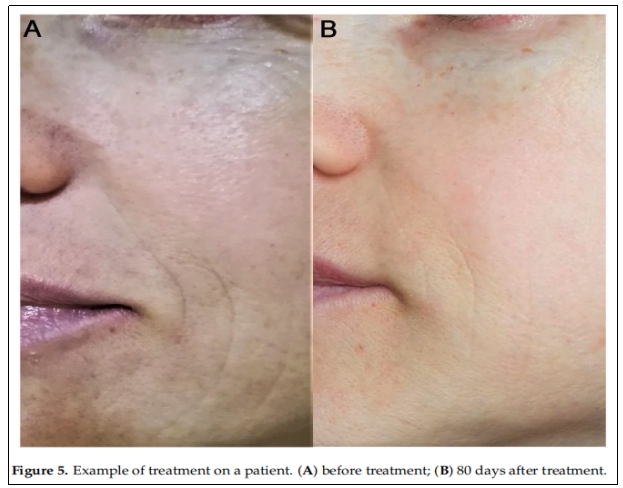 臨床試驗 臨床試驗
