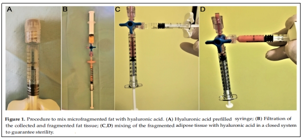 干細胞治療 干細胞治療