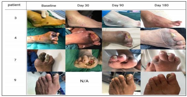 臨床試驗(yàn) 臨床試驗(yàn)