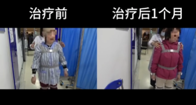 沈女士康復過程 沈女士康復過程